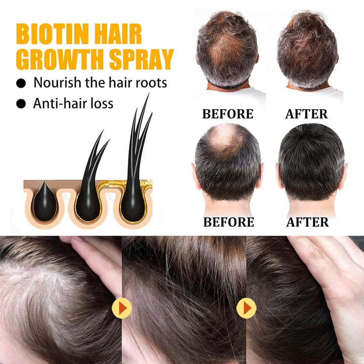 2 bucăți Biotin spray de creștere a părului, ser de creștere a părului, creșterea părului, spray de creștere a părului pentru femei și bărbați, anti-căderea părului, promovează părul mai gros, mai plin și cu creștere mai rapidă Ingrijirea parului Naty Shop